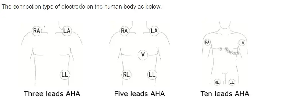 5-afleidingen ECG-geleidingsdraden voor Philips Digitrak plus 24-uurs holter 3100A, 5-afleidingen, Snap